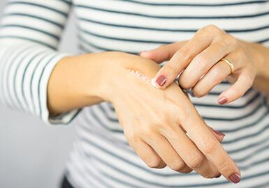 Crème cicatrisante : comment bien la choisir ?