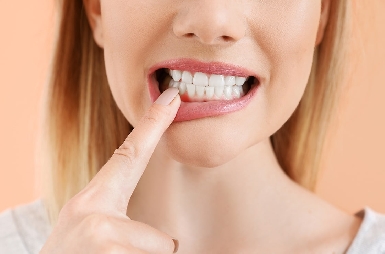 Irritation des gencives : comment en prendre soin ?
