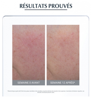 Eucerin Anti Rougeurs Soin De Jour Correcteur SPF25+ Teinté 50 ml
