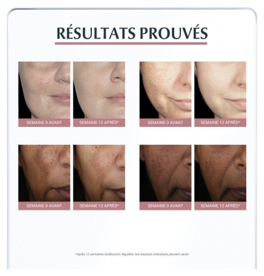 Eucerin Anti-Pigment Correcteur de Taches 5 ml
