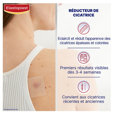 Elastoplast Réducteur de Cicatrices 21 Patchs