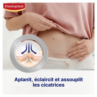 Elastoplast Réducteur de Cicatrices 21 Patchs
