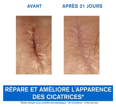 Uriage Bariéderm Cica Crème Réparatrice 40 ml