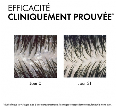 Vichy Dercos Shampoing Traitant Anti-Pelliculaire Cheveux Normaux à Gras 200 ml