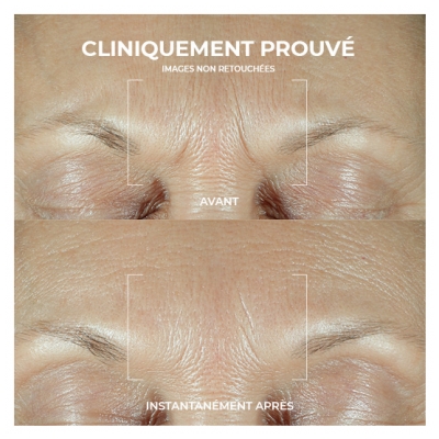 RoC Derm Correxion Sérum Combler + Traiter 15 ml