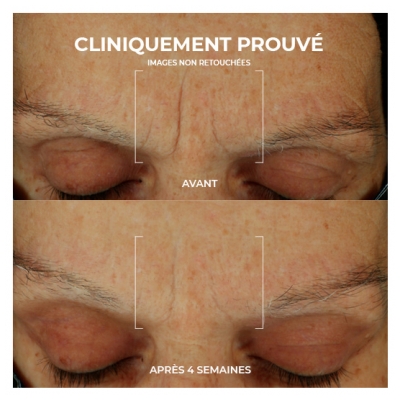 RoC Multi Correxion Soin Lissant Crème Hydratation Maximale 50 ml