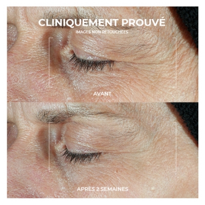 RoC Derm Correxion Duo Soin Contour des Yeux 2 x 10 ml