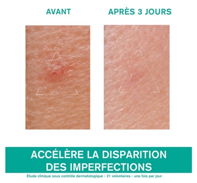 Uriage Hyséac Pâte SOS - Soin Local 15 g