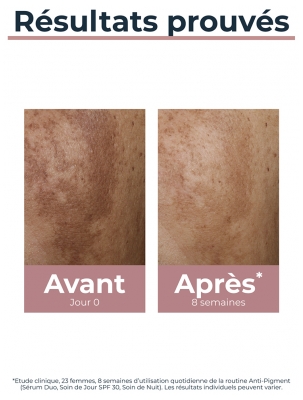 Eucerin Anti-Pigment Soin de Jour SPF30 50 ml