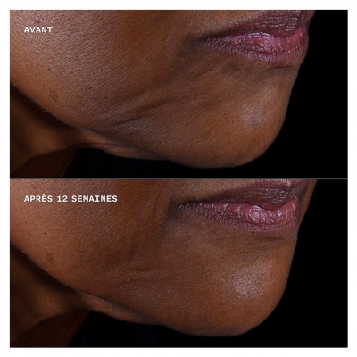 Clinique Smart Clinical Repair Crème Liftante Visage + Cou 50 ml