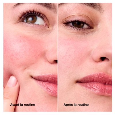 Clinique Redness Solutions Crème Quotidienne Anti-Rougeurs Tous Types de Peau 50 ml