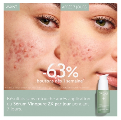 Caudalie Vinopure Blemish Control Salicylic Serum 30ml