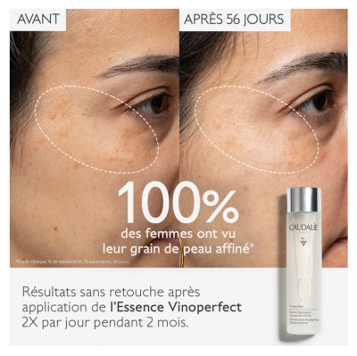 Caudalie Vinoperfect Essence Glycolique Concentrée d'Éclat 100 ml