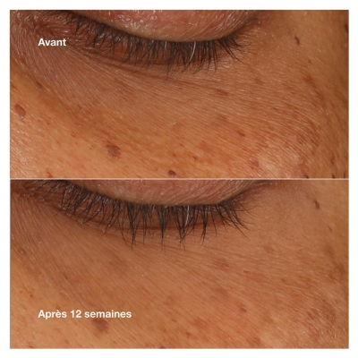 Clinique All About Eyes Sérum Concentré Illuminateur 10 ml