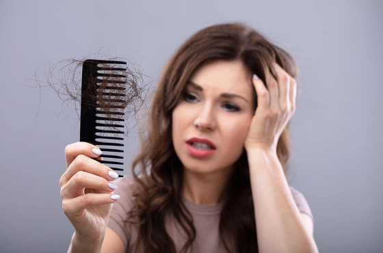 Alopécie, calvitie : comment lutter de façon efficace contre la chute des cheveux ?