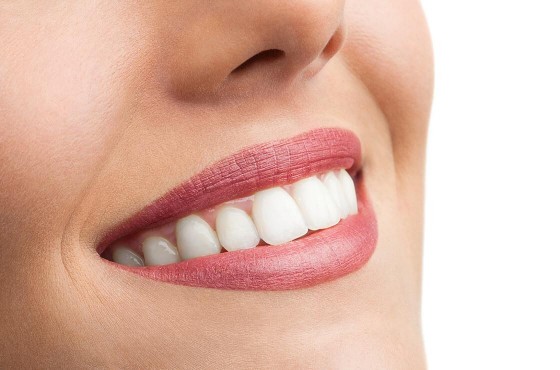 Le blanchiment dentaire : comment fonctionne-t-il ?