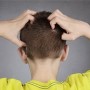 Comment savoir si on a des poux dans les cheveux : guide complet pour les identifier et agir