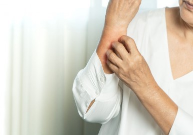 Crème anti démangeaison : solutions efficaces pour apaiser les peaux sensibles et sèches