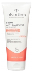 Alvadiem Anti-Eeltcr&egrave;me voor Voeten 75 ml