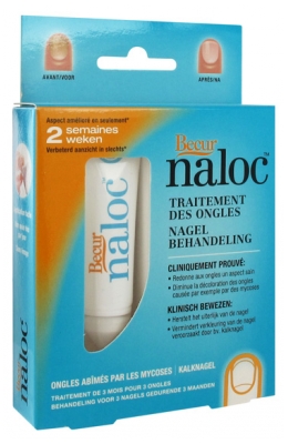 Naloc Nails Treatment