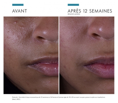 SkinCeuticals Silymarin CF 30 ml