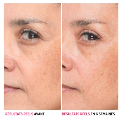 Ser Concentrat Anti-Rid IT Cosmetics Bye Bye Lines 30 ml