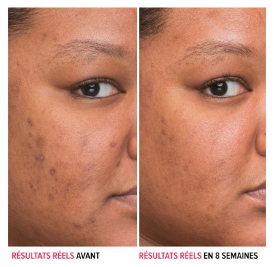 Ser Concentrat Anti-Pete IT Cosmetics Bye Bye Dark Spots 30 ml