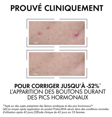 Vichy Normaderm Probio-BHA Sérum Anti-Imperfections 30 ml