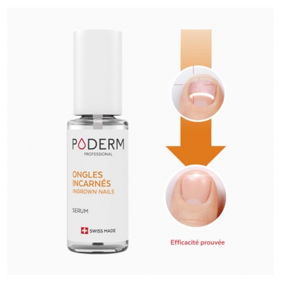 Poderm Indgroet Negleserum 8 ml