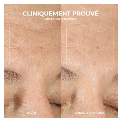 RoC Multi Correxion Renouveau + Éclat Correxion Gel Nettoyant 177 ml