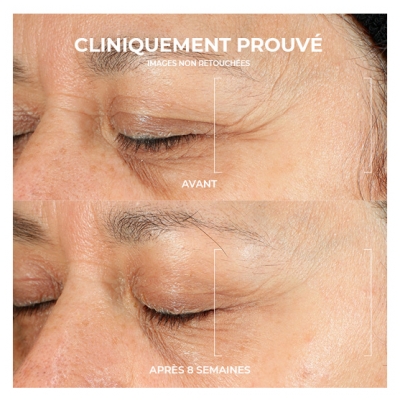 RoC Multi Correxion Renouveau + Éclat Sérum Quotidien 30 ml