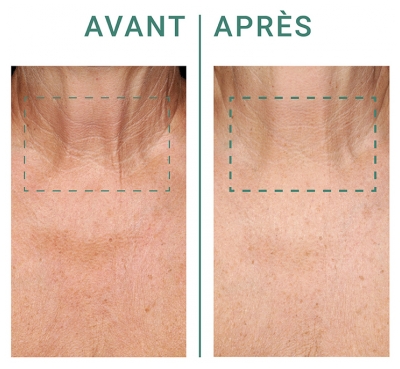 Dr Pierre Ricaud Crème Lifting Cou & Décolleté 50 ml