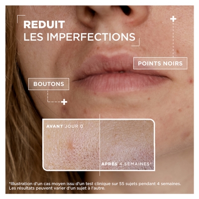 Mixa Sérum Concentré Anti-Imperfections Acide Salycilique + Niacinamide 30 ml