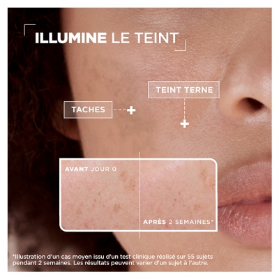 Mixa Sérum Concentré Anti-Taches Vitamine C + Acide Glycolique 30 ml