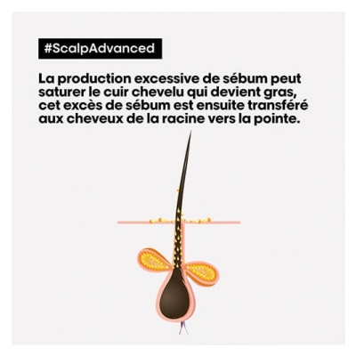 Scalp Advanced L'Oréal Argile Shampooing-masque 2-en-1 Purifiant Profond Scalp Advanced L'Oréal Pro