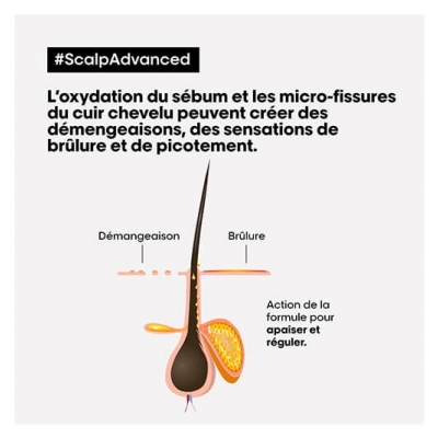 Scalp Advanced L'Oréal Traitement Apaisant Intense Scalp Advanced L'Oréal Pro