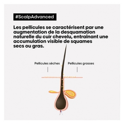Scalp Advanced L'Oréal Shampooing Dermo-clarifiant Anti-pelliculaire Scalp Advanced L'Oréal Pro 500ml