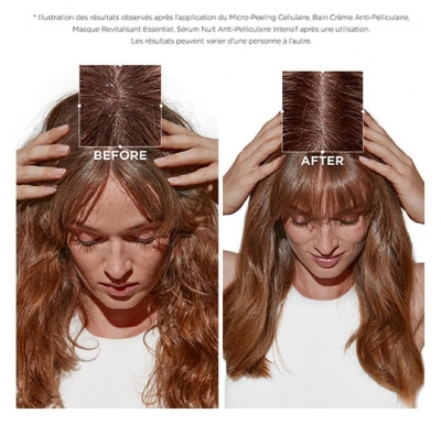 Kérastase Bain Crème Anti-pelliculaire Symbiose