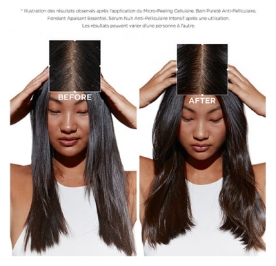 Kérastase Sérum Cellulaire Nuit Anti-pelliculaire Intensif Symbiose