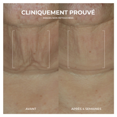 RoC Derm Correxion Serum Raffermissant au Retinol 30 g