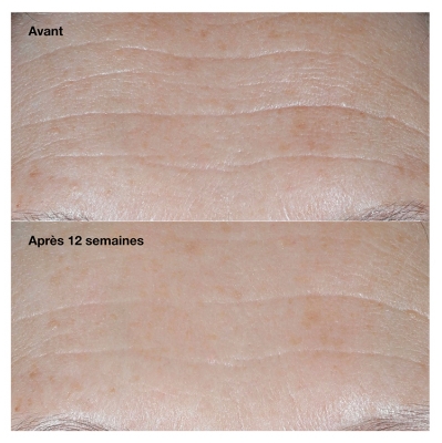 Clinique Smart Clinical Repair Crème Correctrice Anti-Rides SPF30 50 ml