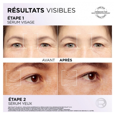 L'Oréal Paris Revitalift Filler Hyaluron Sérum Rides & Hydratation 30 ml