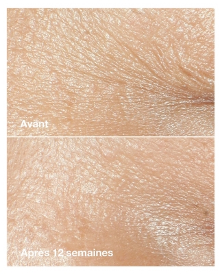 Clinique Smart Clinical Repair Crème Correctrice Anti-Rides 50 ml