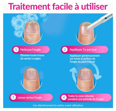 Excilor Easy Traitement Mycose de l'Ongle Déjaunissement Actif 4 ml