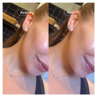 Omum Tonēts Mitrinošs Sejas Krēms SPF50 Bio 40 ml - Tonēšana: Zelta