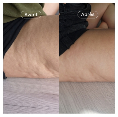 Omum Coach Nutricosmetic 60 Capsule