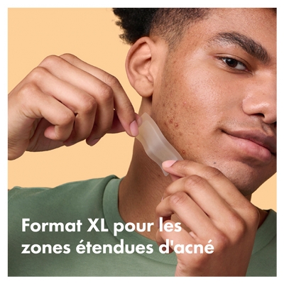 Hero Mighty Patch Surface Patchs Anti-Acné Zones Étendues 10 Patchs Hydrocolloïdes