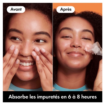 Hero Mighty Patch Nose 10 Patchs Hydrocolloïdes