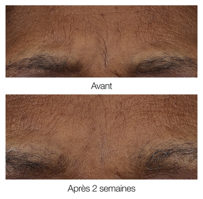 Clinique Smart Clinical Repair Baume Rétinoïde Matin/Soir 3 g