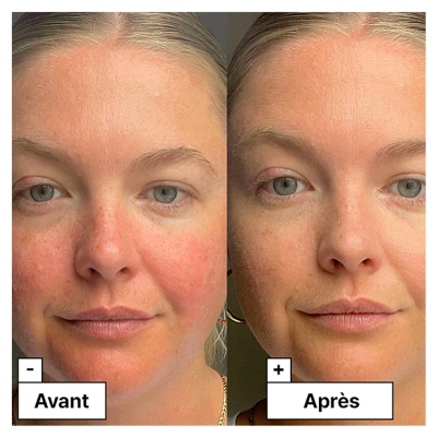 Dr. Jart+ Cicapair Tiger Grass Fluide Correcteur à l'Herbe du Tigre SPF35 30 ml